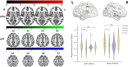 ALFF and ReHo analyses in patients with LLD and HCs. The results showed that both ALFF of left paracentral lobule and ReHo of right superior temporal gyrus had interactive effects between diagnosis and sex (tests of between-subjects effect in diagnosis×sex: P = 0.001, P < 0.001; effect size = 11.018, 22.073). In addition, an independent samples t-test indicated a statistically significant difference in ReHo and ALFF...