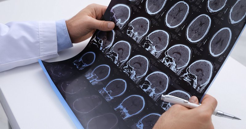 Black and white images from brain CT scan