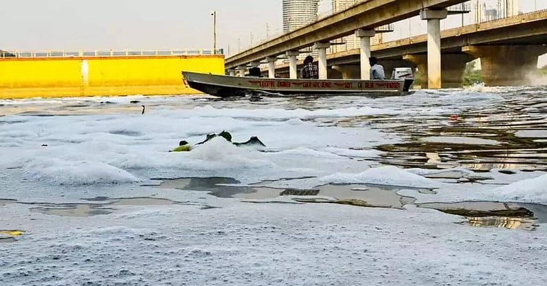 Representative image