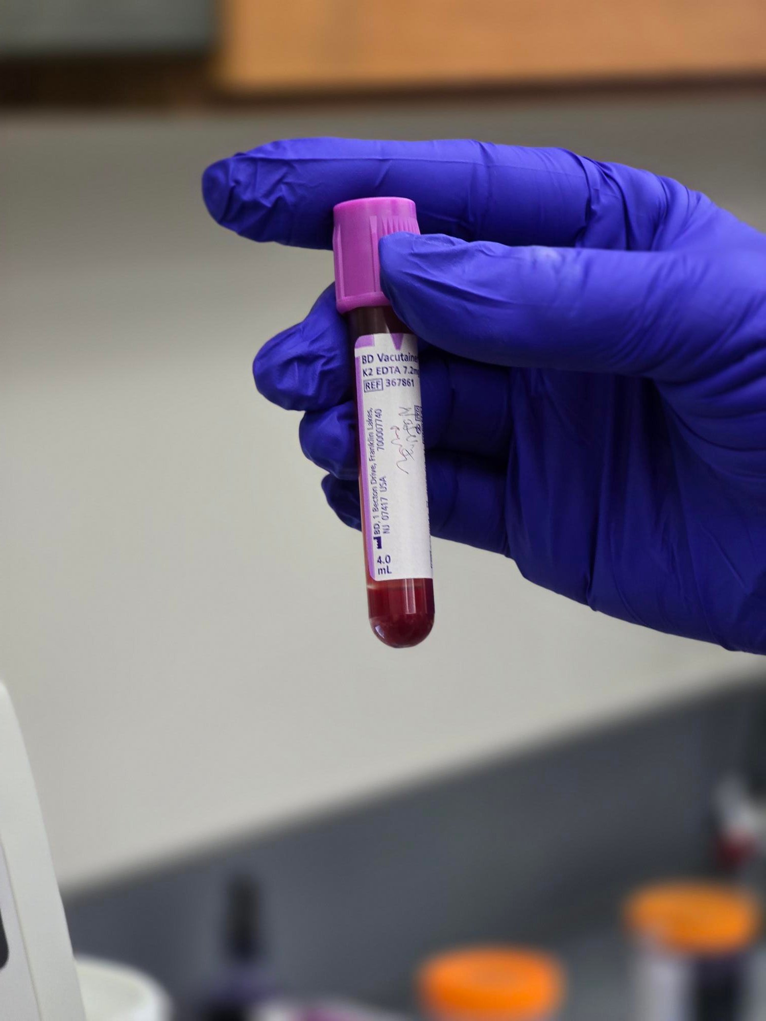 A gloved hand holding a labeled blood collection tube with a purple cap in a laboratory setting.