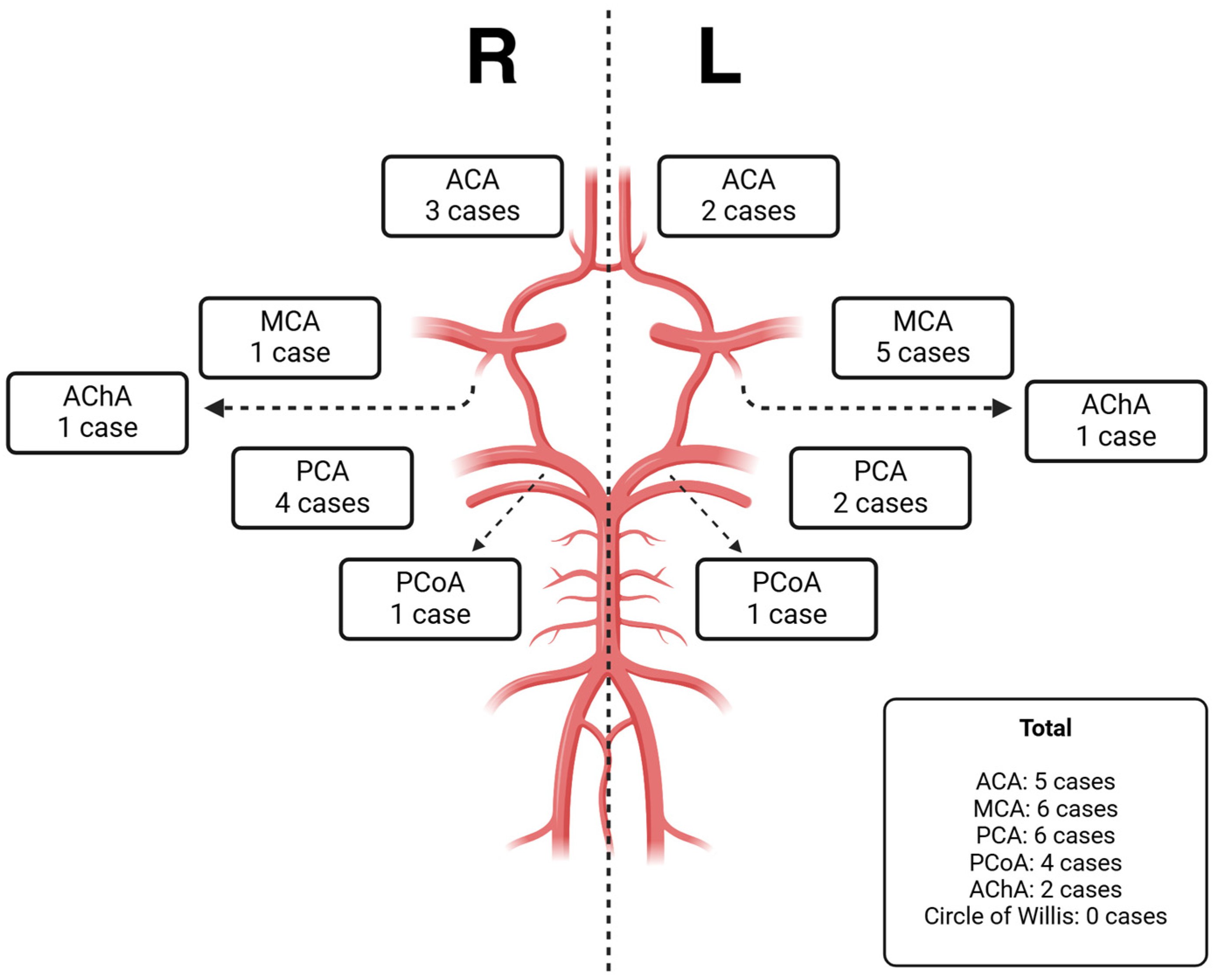  Location of perforator strokes.
