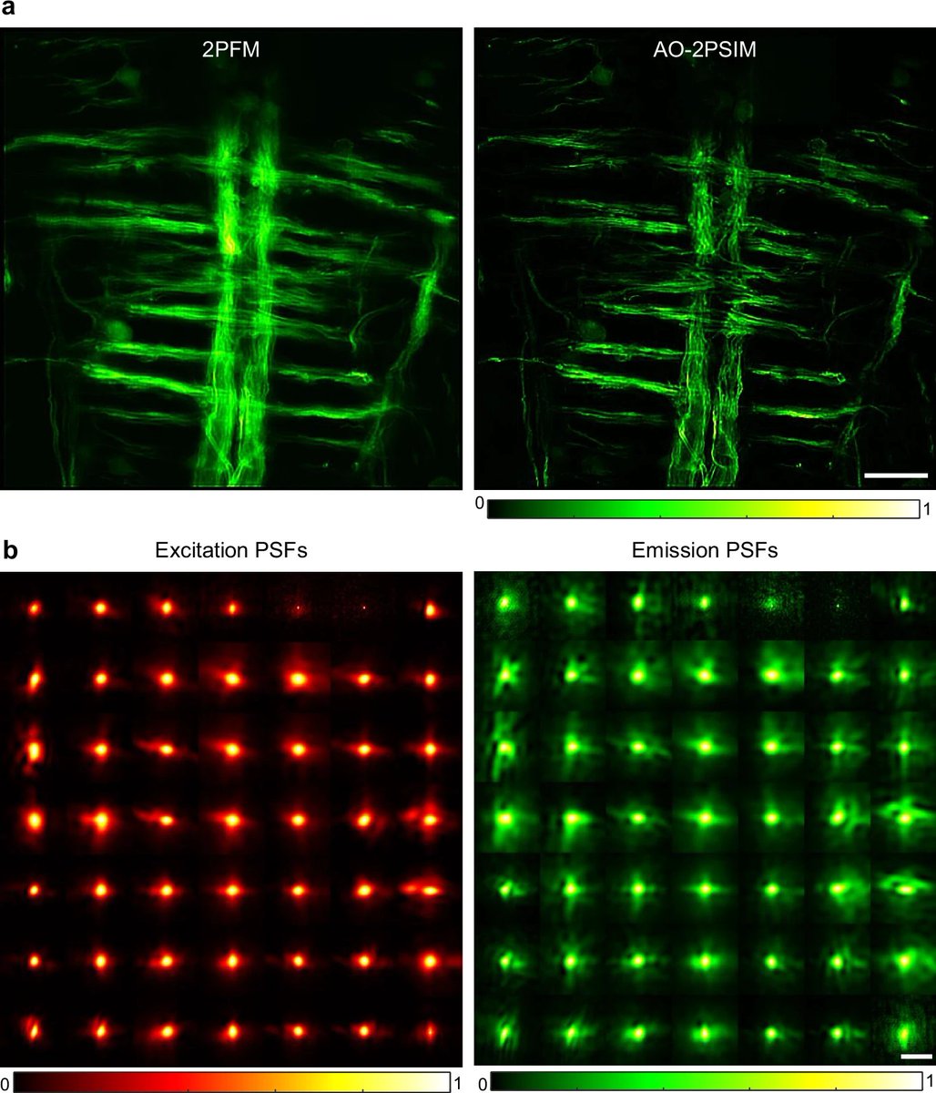 Fig. 6: Two-photon imaging of zebrafish hindbrain.
Lim S, Kang S, Hong JH, Jin YH, Gupta K, Kim M, Kim S, Choi W, Yoon S. Dual deconvolution in multiphoton structured illumination microscopy for deep-tissue super-resolution imaging. Nat Commun. 2026 Mar 4;17(1):2123. doi: 10.1038/s41467-026-69798-y. PMID: 41781392; PMCID: PMC12960828.