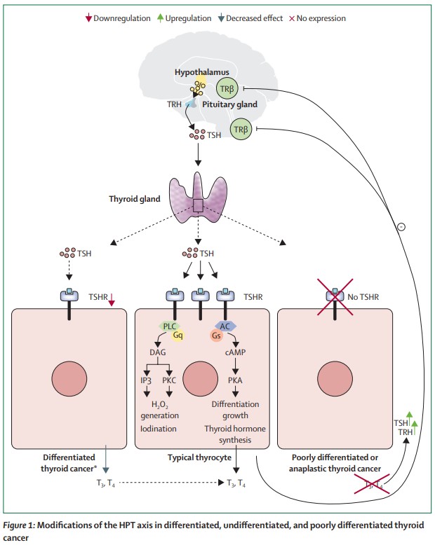 TRH produced by the hypothalamus stimulates the production of TSH by the pituitary gland, which binds to its cognate receptor TSHR on thyrocytes of the thyroid gland and stimulates thyroid hormone production, thyroid growth, and differentiation. TSHR expression is downregulated in differentiated thyroid cancer cells, which synthesise lower concentrations of thyroid hormones. Undifferentiated thyroid cancer cells do not express TSHR, and therefore, are incapable of responding to TSH stimulation. The synthesis and secretion of TRH and TSH is regulated by free thyroid hormones concentrations through a negative feedback mechanism. Image created with BioRender. HPT-hypothalamic–pituitary–thyroid. T3=tri-iodothyronine. T4=thyroxine. TRH=thyrotropin-releasing hormone. TSH=thyroid-stimulating hormone. TSHR=TSH receptor. *Only a small percentage of well differentiated follicular thyroid cancers produce thyroid hormones.