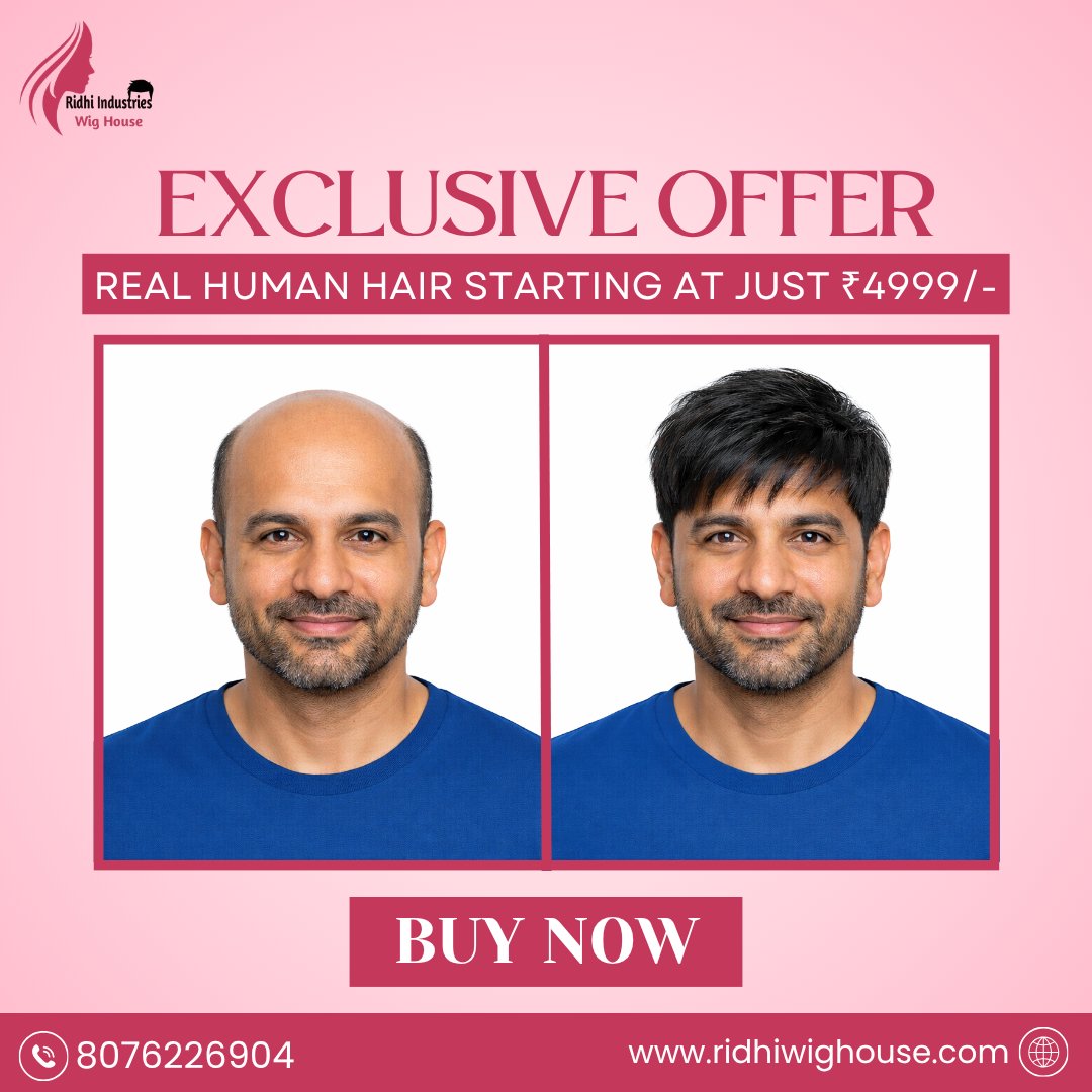 ✨ Transform Your Look Instantly! ✨

Say goodbye to hair loss and hello to confidence with our Premium Real Human Hair Patch 💯
Get a natural, undetectable look that blends perfectly with your scalp – just like real hair!

🔥 Exclusive Offer
💰 Starting at just ₹4999/-
👨‍🦱 100% Real Human Hair
✨ Natural Hairline & Perfect Finish
💨 Lightweight & Breathable
🛠️ Easy to Fix | No Surgery Required

Upgrade your style and boost your confidence today with Ridhi Industries Wig House ❤️

📦 Pan India Delivery Available
📞 Call/WhatsApp: +91 8130067129
🌐 Website: www.ridhiwighouse.com

👉 Don’t wait – Buy Now & Get Your Perfect Hair Look!

#RidhiIndustries #hairpatch #hairpatchformen #hairpatchprice #hairpatchcost #besthairpatch #realistichairpatch #undetectablehairpatch #premiumhairpatch #hairwigformen #malewig #humanhairwig #nonsurgicalhairpatch #RidhiWigHouse 