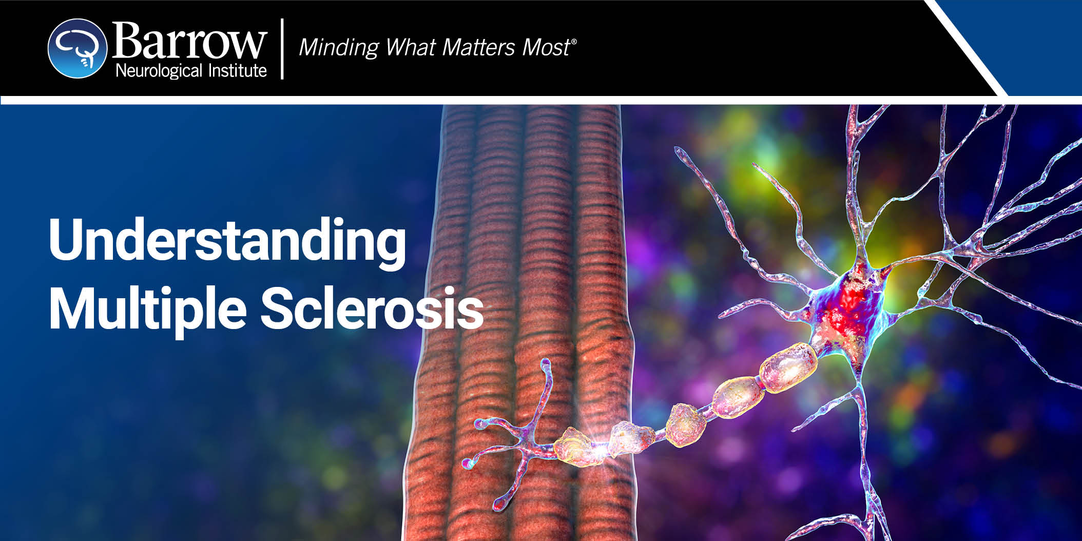 Illustration of the myelin sheath. Text: Understanding Multiple Sclerosis
