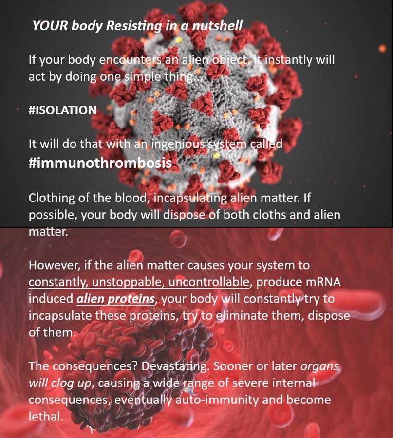 The experimental genes therapies, on molecular level, cause your body become the producer of the spike enzyme. This is a dangerous unstoppable and uncontrollable process, that doesn't stop!

The vast array of severe, (lethal), complications, are caused by a natural reaction of the immune system called immuno thrombosis. These clog the capillaries of your brains, heart and other vital organs, eventually shutting them down.

The severe medical complications described all over, the excessive mortality rates, are due to here above, yet denied by many gvts, unwilling to take any responsibility for the genocide like state.

Many more vaccinated are to succumb and entities continue to deflect the issue by mass publish all sorts of statement, away from this reality.

RC