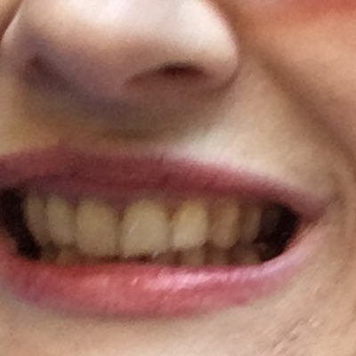 Forelle 🇺🇦🇸🇻💚