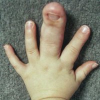 The Real Large Finger