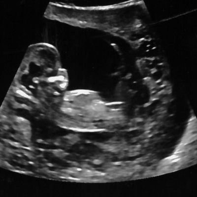 πππππ ππ πππππ