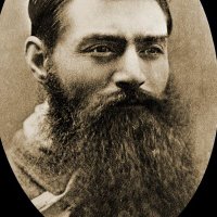 The beard of Jack Dorsey