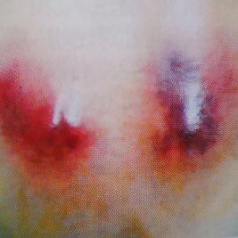 Real Doctor-Cases of pain cure