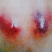 Real Doctor-Cases of pain cure