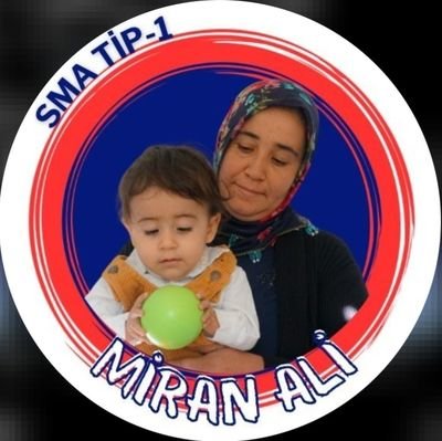 MİRAN ALİ KAZANDI 🏆