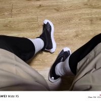 疯狂燃烧的腿毛