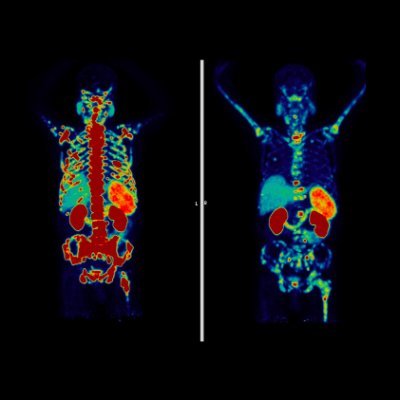 PSMA & Beyond Conference