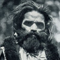 Шкрбави Јашари