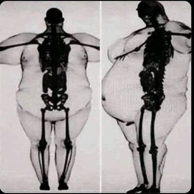 prof. Antoni Kupelweizer