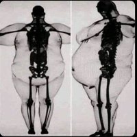 prof. Antoni Kupelweizer