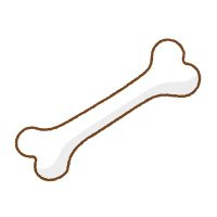 骨延長をした男