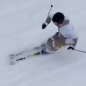 とんがり〜2年連続ACL再建から復帰目指す人