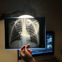 Rad Emmak☢️⚠️