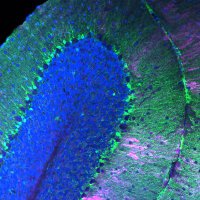Synapse Biology Group | NCBio ERA Chair @i3S_Porto