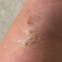 Little Brother Crashout