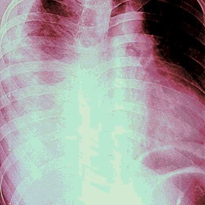 personal log °*•*°• |||