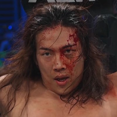 ☆⨻𝔉𝔯𝔢𝔡𝔡𝔦𝔢⨻☆