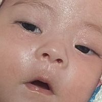 3m低体重・染色体異常指定難病プラダー・ウィリー症候群pws(修正2m)🦖