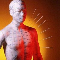 Northfield Acupuncture Clinic