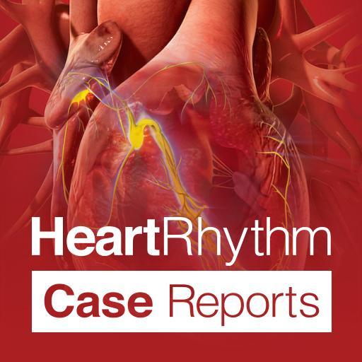 Heart Rhythm Case Reports